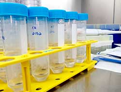 Análise Microbiológica da água